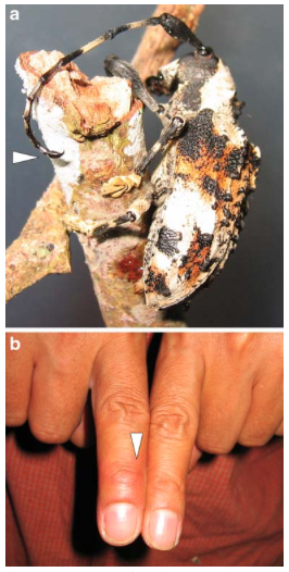 Figure 1 : Individu de Onychocerus albitarsis - a) la flèche indique l'organe piqueur au bout de l'antenne - b) la flèche indique l'endroit de la piqûre et le gonflement du doigts (Source : Barkov et al., 2008)